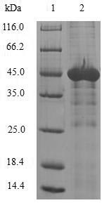 Human NAA50 Protein蛋白,orb54258