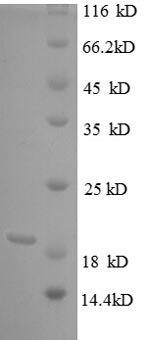 Bovine TNF Protein蛋白，orb604424