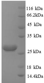 Human HPRT1 Protein蛋白，orb70460
