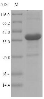 Bacterial Invasin Protein蛋白，or