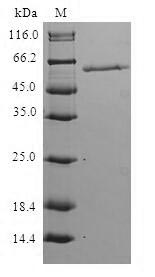 Human HPS1 Protein蛋白，orb54402，