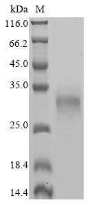 Human CTHRC1 Protein蛋白，orb7051