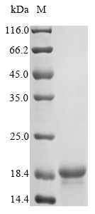 Virus CUP1-1 Protein蛋白，orb6045