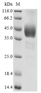 重组蛋白 Human 5-hydroxytryptamine