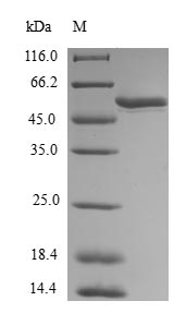Human MEOX1 Protein蛋白，orb54466