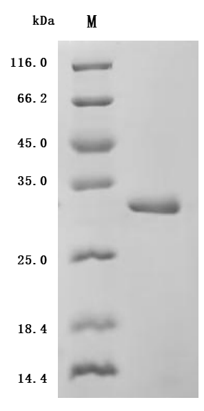 Human IL6 Protein蛋白，orb604194，