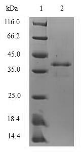 Mouse S100A8 Protein蛋白,orb4187