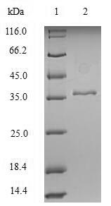 Human KRT18 Protein蛋白，orb54091