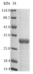 E. coli fimH Protein蛋白，orb6047