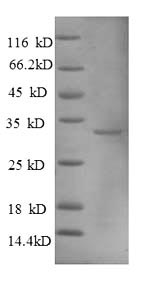 Human MT1A Protein蛋白,orb604258