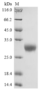 Primate OSM Protein蛋白，orb60540