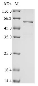 coronavirus HKU1 Nucleo Protei