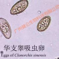 华支睾吸虫IgM抗体试剂盒(ELISA法)说明书
