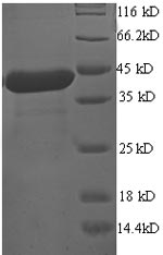 Human ALG2 Protein蛋白，orb704599