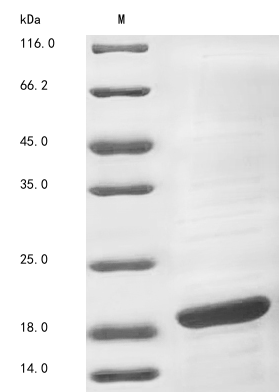 Bacteria acpS Protein蛋白，orb604