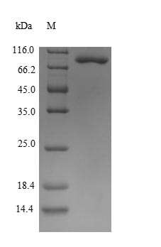 Human ENO1 Protein蛋白，orb604064