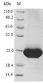 Human CXCR4 Protein蛋白，orb9925，