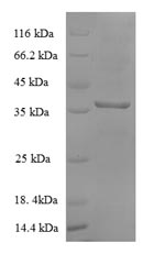 E. coli mdh Protein蛋白，orb60424