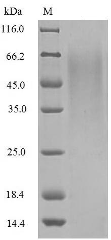 Influenza B virus Non-structur
