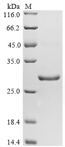 Animal Schistosoma japonicum G