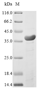 Virus map Protein蛋白，orb604244，