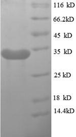 Virus Hirudo medicinalis Hirud