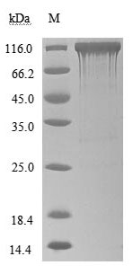 Human Angiotensin-converting e