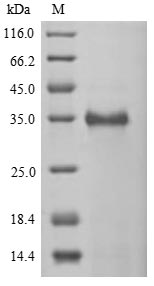 Human CTAG2 Protein蛋白，orb60531