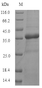 Human TMEM65 Protein蛋白,orb5469