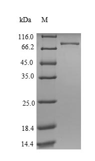 Human ATP5A1 Protein蛋白，orb4187