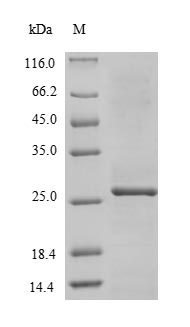 Viral RNA-directed RNA polymer