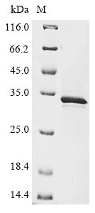 Human FAM20C Protein蛋白，orb7046