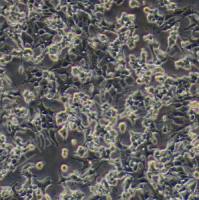 人前列腺癌细胞；22Rv1(STR)