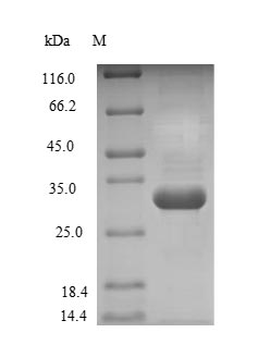 Human GSTP1 Protein蛋白，orb60414