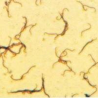 华支睾吸虫（肝吸虫）IgG抗体酶免试剂盒