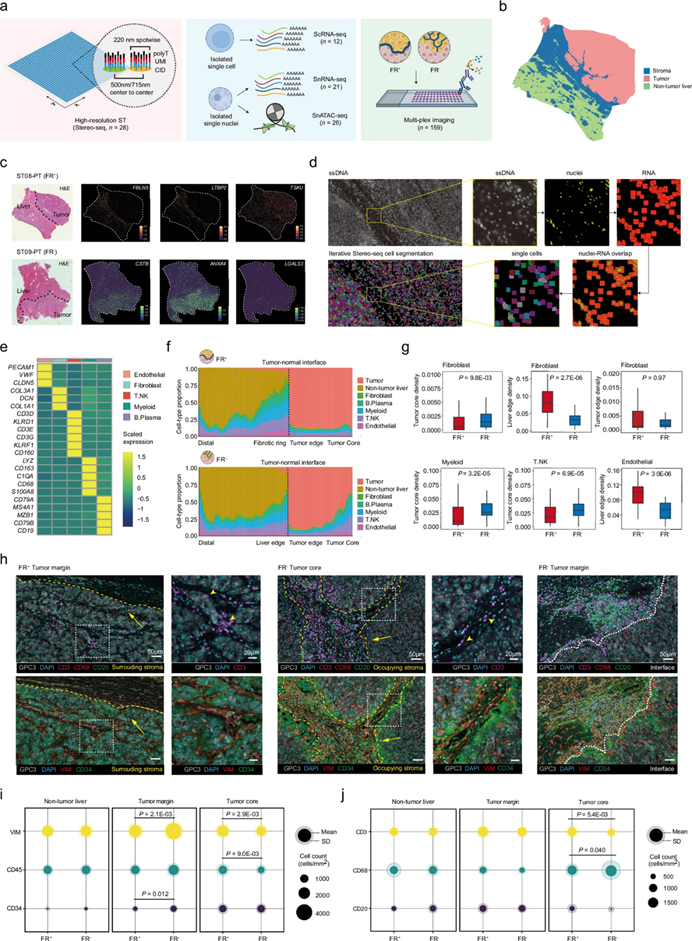 Cell Discovery| Tissue Cytometry技术助力复旦大学樊嘉院士团队揭示CAF 亚群互作新机制