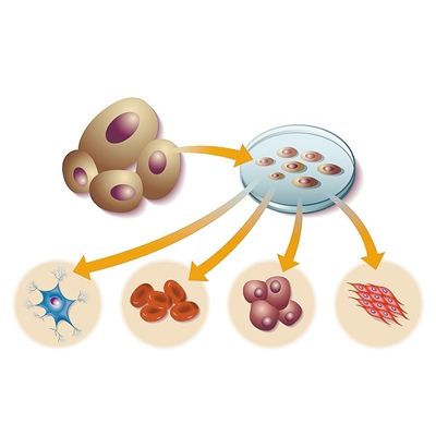 耐药类器官模型筛选