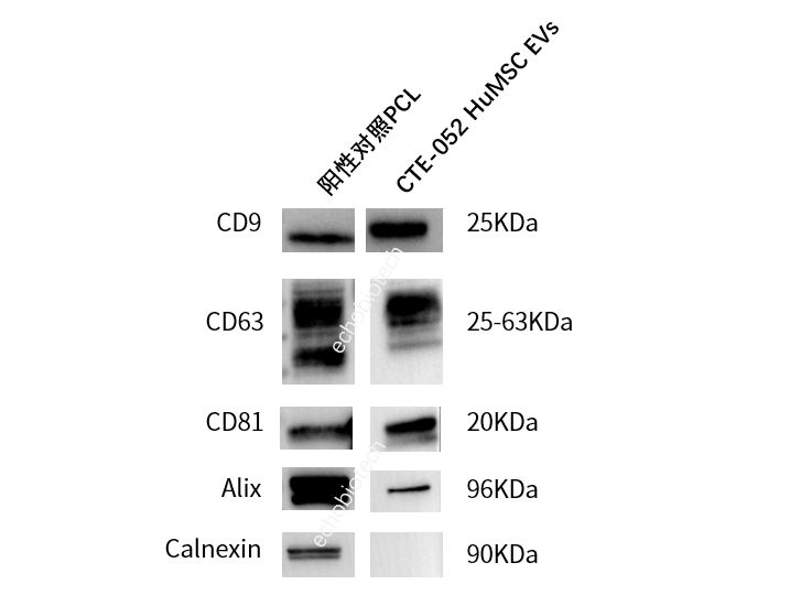 上新-ExosuperQC外泌体4阳1阴WB鉴定试剂盒-CD