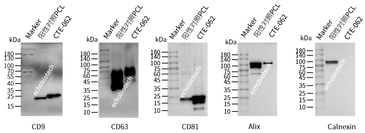上新-ExosuperQC外泌体4阳1阴WB鉴定试剂盒-CD