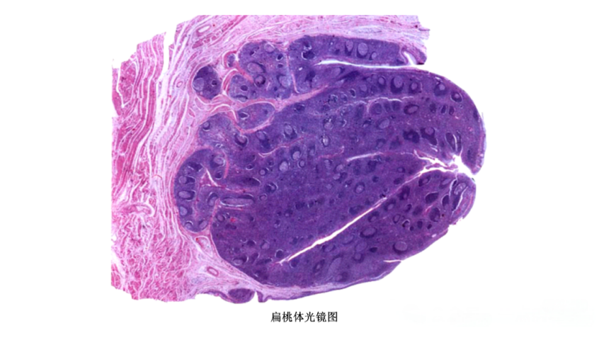 扁桃体结构示意图