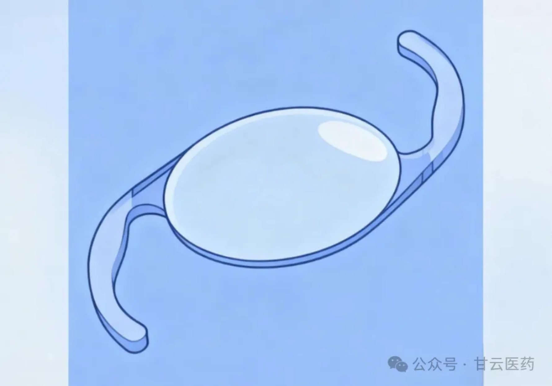 眼科中的“珠”多应用:从纳米药物到人工晶体