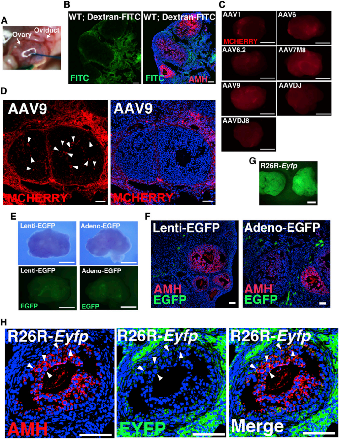 【AAV在卵巢中的应用】AAV介导的卵巢靶向基因递送能够恢复先天性不孕小鼠的生育能力