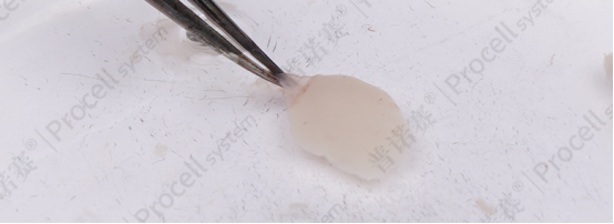 左手辅助固定脑组织，右手使用解剖镊撕下脑膜