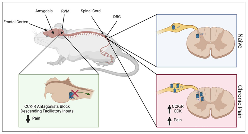 破解疼痛与癌症的关联密码:CCK2受体探秘