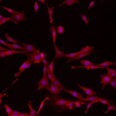 类器官-肿瘤相关成纤维细胞(CAF)共培养模型