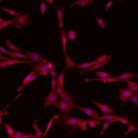 类器官-肿瘤相关成纤维细胞(CAF)共培养模型