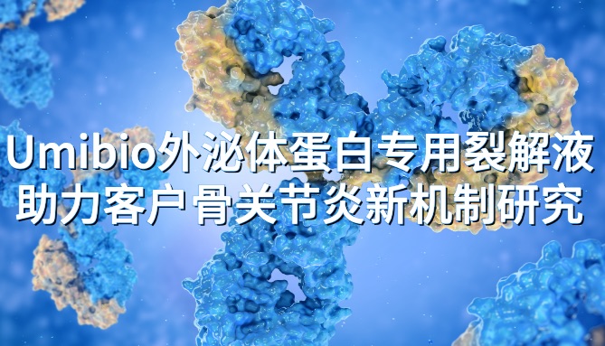IF=14.5 | Umibio外泌体蛋白专用裂解液助力客户骨关节炎新机制研究！