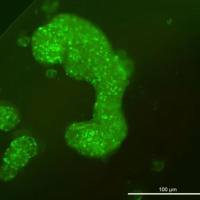 类器官-慢病毒套餐