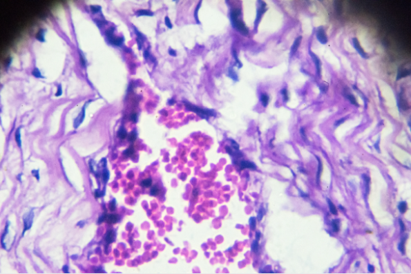 兔关节囊成纤维细胞消化后如何计数