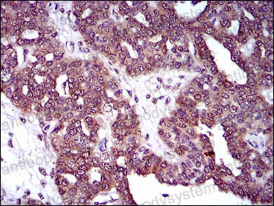 佰乐博生物蛋白抗体------线粒体动力学关键调控因子Anti-DRP1/DNM1L Antibody (R2T47)动力蛋白相关蛋白抗体
